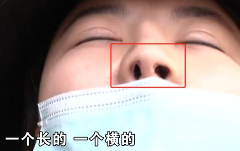 女子花4万8整容修复后要索赔,一名女子花几十万整容结果后悔了