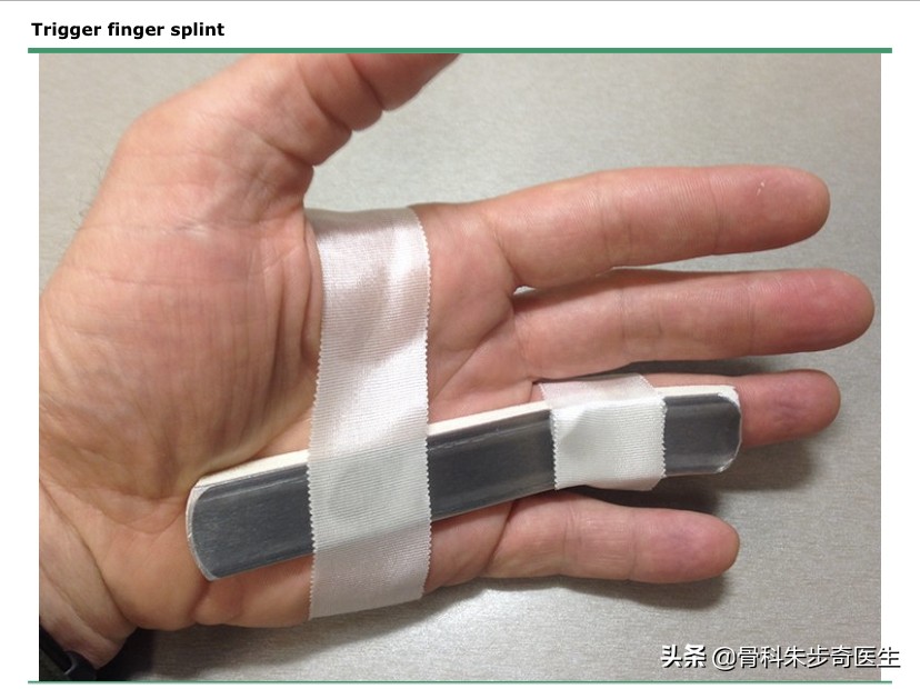 患者故事：今天说说，腱鞘炎究竟应该怎么治疗？需要不需要手术？