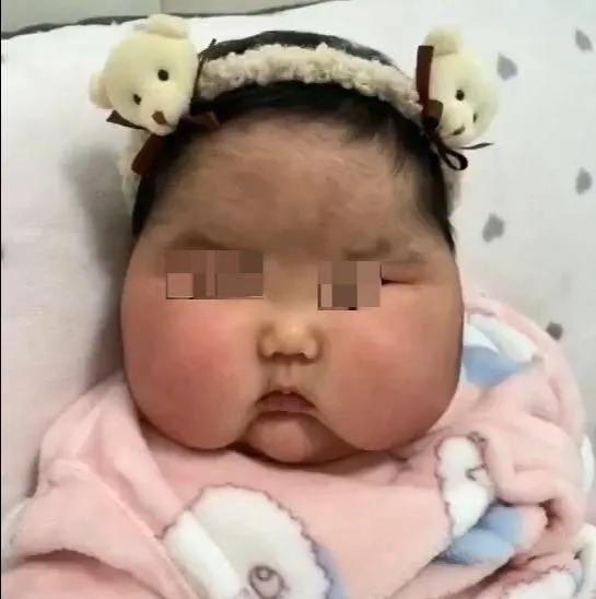 外用药膏一般能维持多久,外用药膏出现不良反应怎么处理