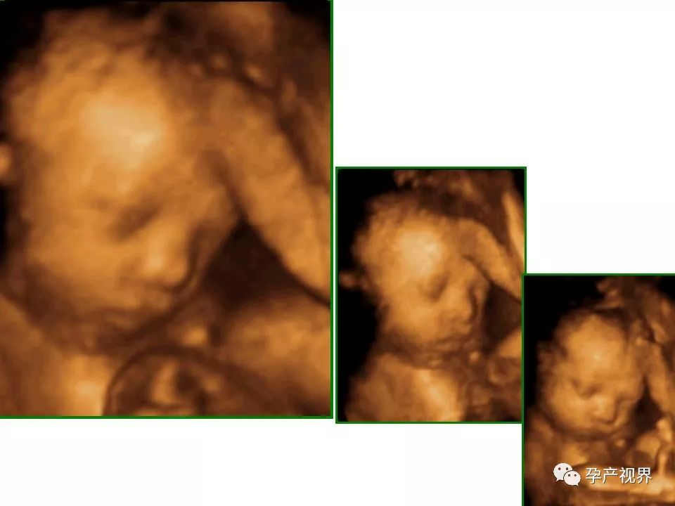 怀孕9周有褐色分泌物b超检查正常,怀孕30周大检查一般检查哪些项目