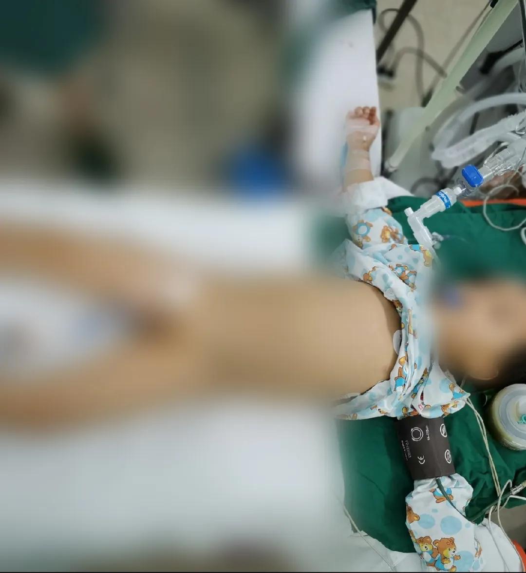 小孩子做了小肠气手术注意什么,儿童小肠切除后遗症