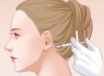 打了瘦脸针运动会瘦吗,瘦脸针要打多久才会瘦