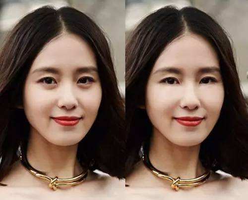 眼袋越来越严重赶紧试试这个方法,大家是否知道眼袋形成的原因呢