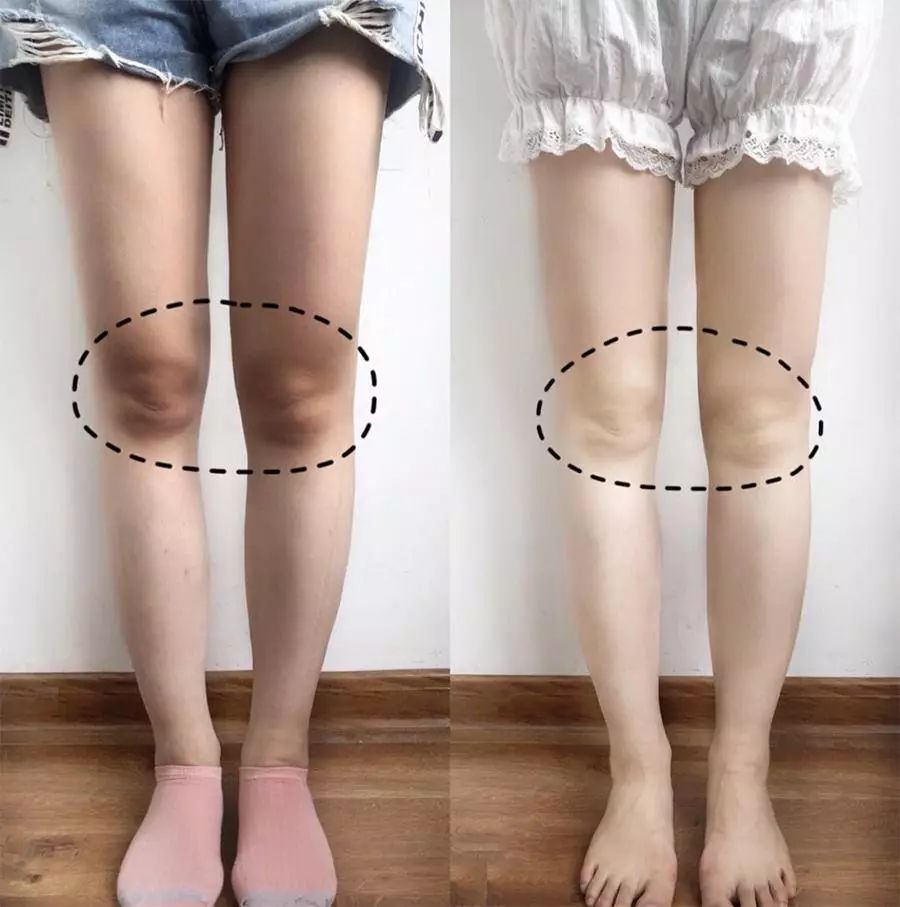 郑爽同款漫画腿不动刀也能get？吴昕的萝卜腿有救了