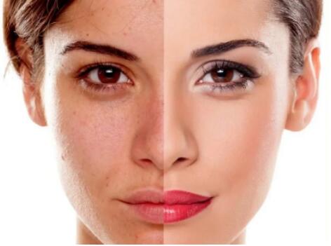 德国安娜柏林,柏琳芦荟蜜