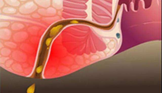 别人坐过的热板凳凉了能坐吗,别人坐过的热凳子会传染病吗