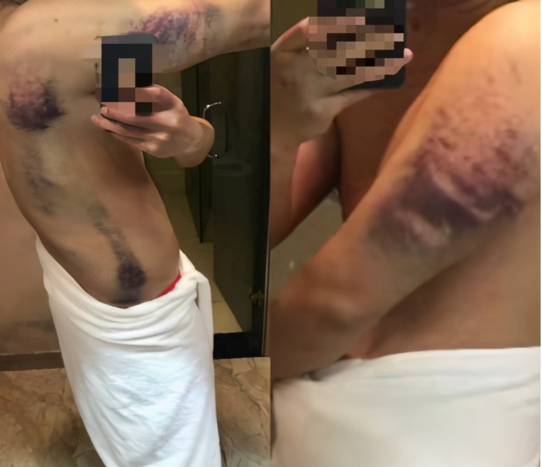 【关注】皮鞭、木棍、水牢……揭秘缅北的“发财梦”!