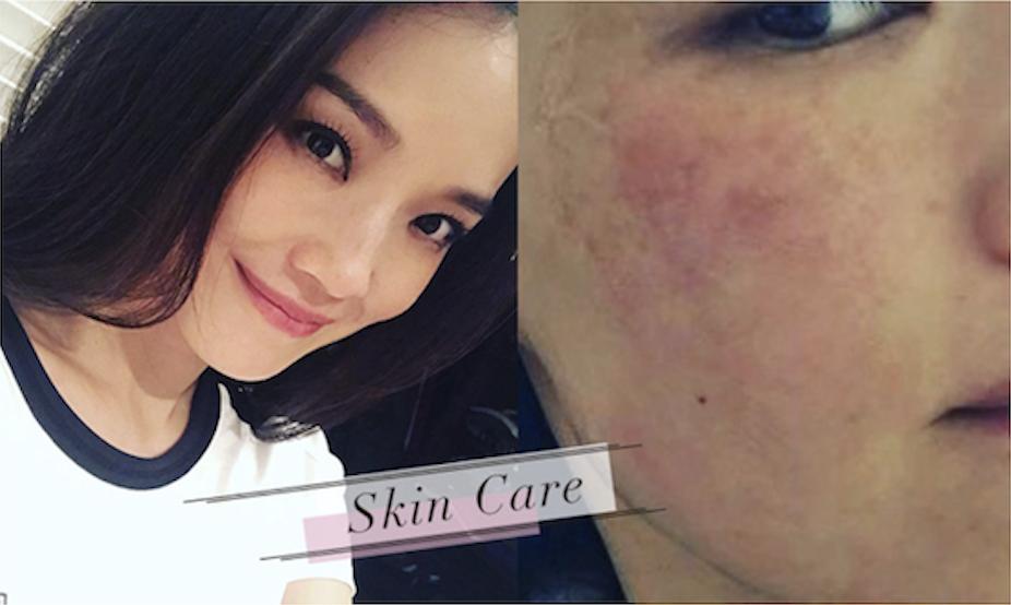 敲黑板怎么看懂,教你快速辨别各类问题肌肤