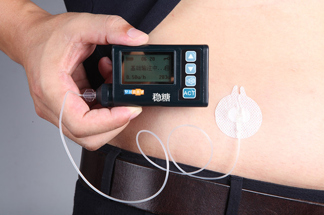 胰岛素泵一个月的耗材费,medtronic胰岛素泵耗材价格