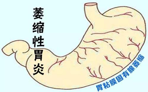 这7种癌症或能治愈,这7种癌都是吃出来的