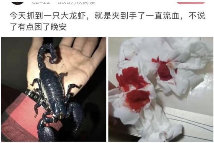 被龙虾夹了一下,手被龙虾的钳子夹了会怎么样