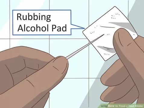 怎么预防跑步起水泡,一到夏天跑步脚就起泡怎么办