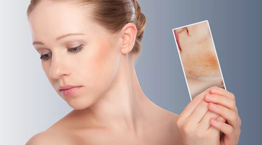 脸部过敏泛红长痘怎么改善,脸部敏感泛红反复长痘