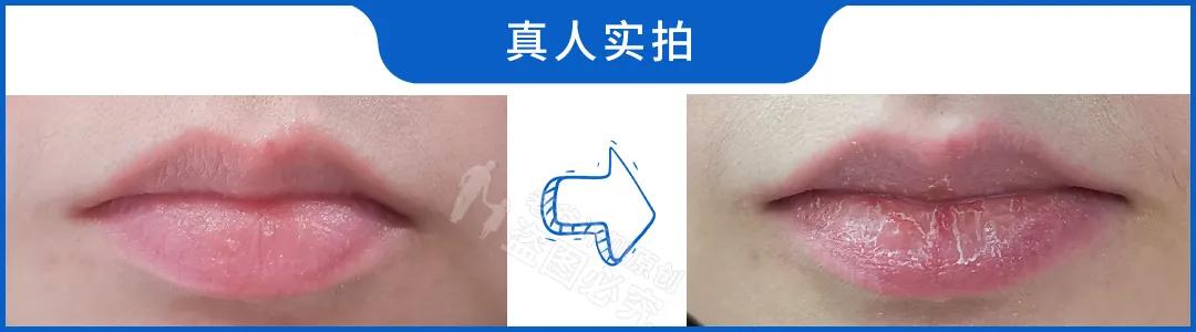 嘴干嘴裂的唇膏,嘴干嘴裂润唇膏