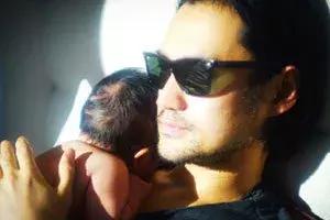 拯救发际线告别大额头,拯救发际线不走冤枉路