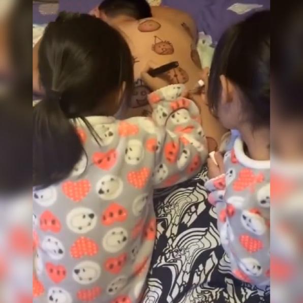 爸爸拔罐留下的印子,爸爸拔火罐后续