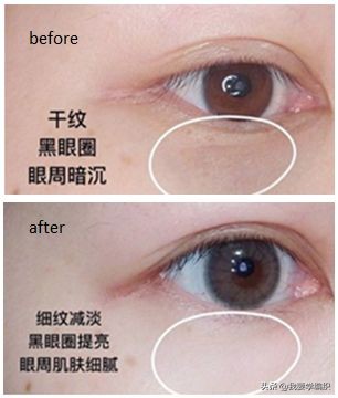 雅诗兰黛眼霜去细纹效果怎么样,雅诗兰黛祛眼纹吗