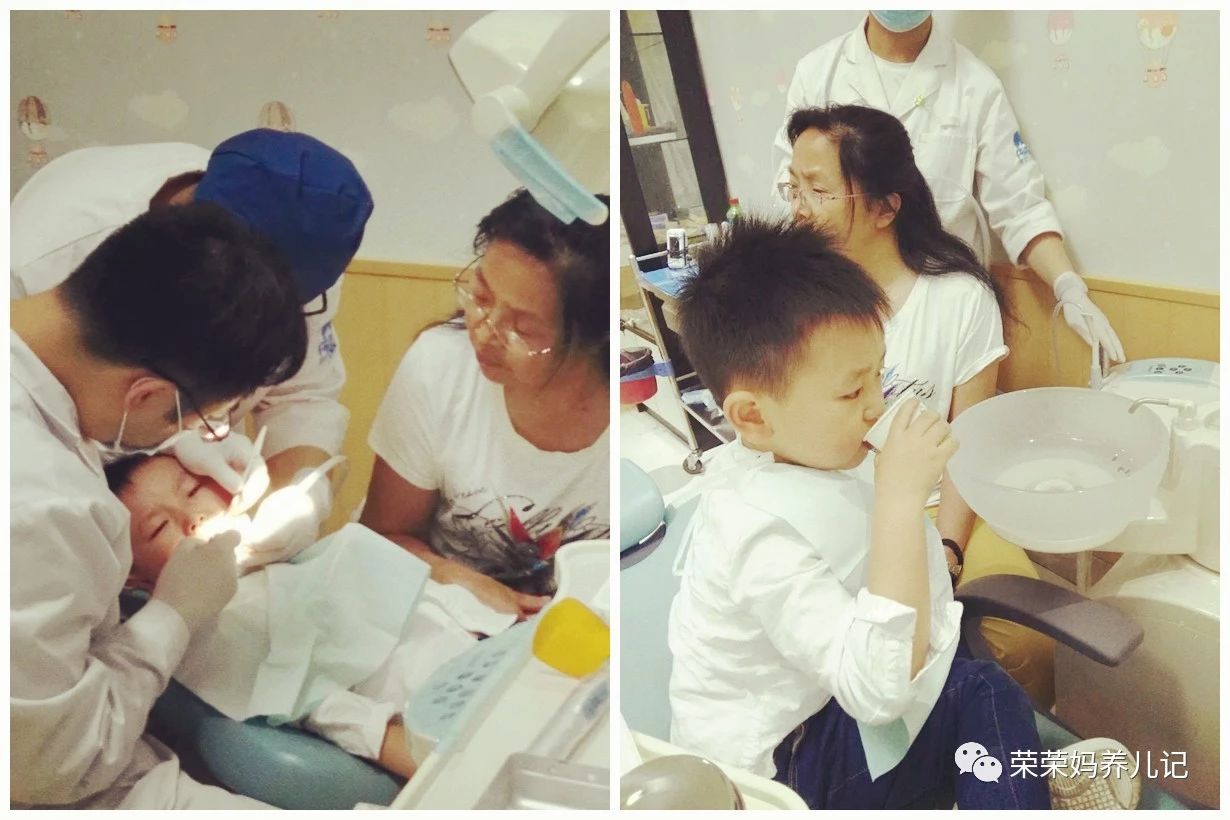 窝沟封闭预防龋齿会有什么危害吗,窝沟封闭后将有效预防孩子龋齿