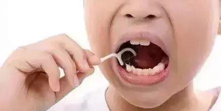 三种习惯让宝宝烂牙,宝宝烂牙是怎么回事