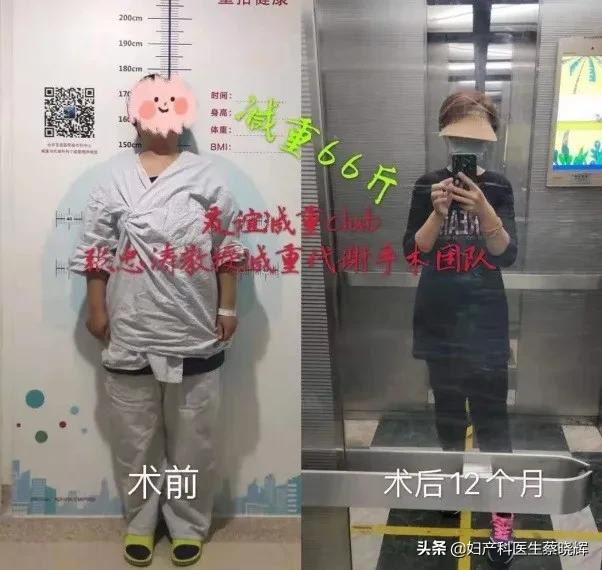 体重快速下降要警惕肿瘤,赘肉长期不离身容易生病