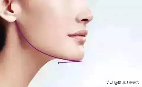 佛山华美好不好,佛山华美整形美容医院高明区