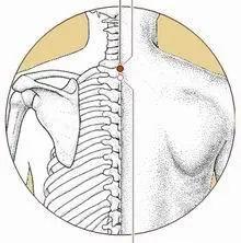 一招解决睡落枕,落枕后怎么睡能缓解疼痛