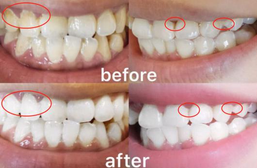 濂冲+鍙h厰棣欐按鎸佷箙鐣欓,濂介椈鍙h厰鍠烽浘棣欐按