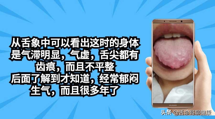舌诊哥说亚健康,抖音舌诊哥舌象分析