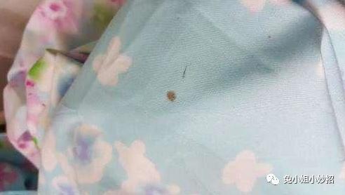 衣服上有血洗不掉怎么办呀,衣服陈旧的血渍84可以清除吗