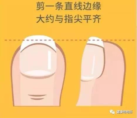 指甲没剪好怎么修复,指甲没做好怎么补救