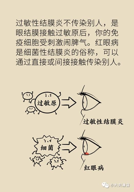 眼睛又痒又红又痛，过敏性结膜炎用这几招立马缓解