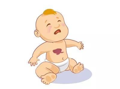 血管瘤复发的六大原因,曾经有血管瘤还会复发吗