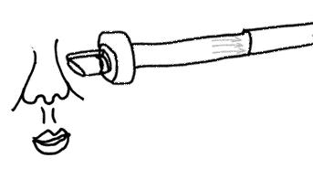 解决顽固黑头轻松去除草莓鼻,祛闭口粉刺草莓鼻