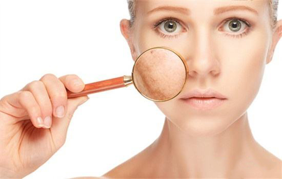 大干皮怎么补水效果最好,干皮怎么补水嫩白保湿