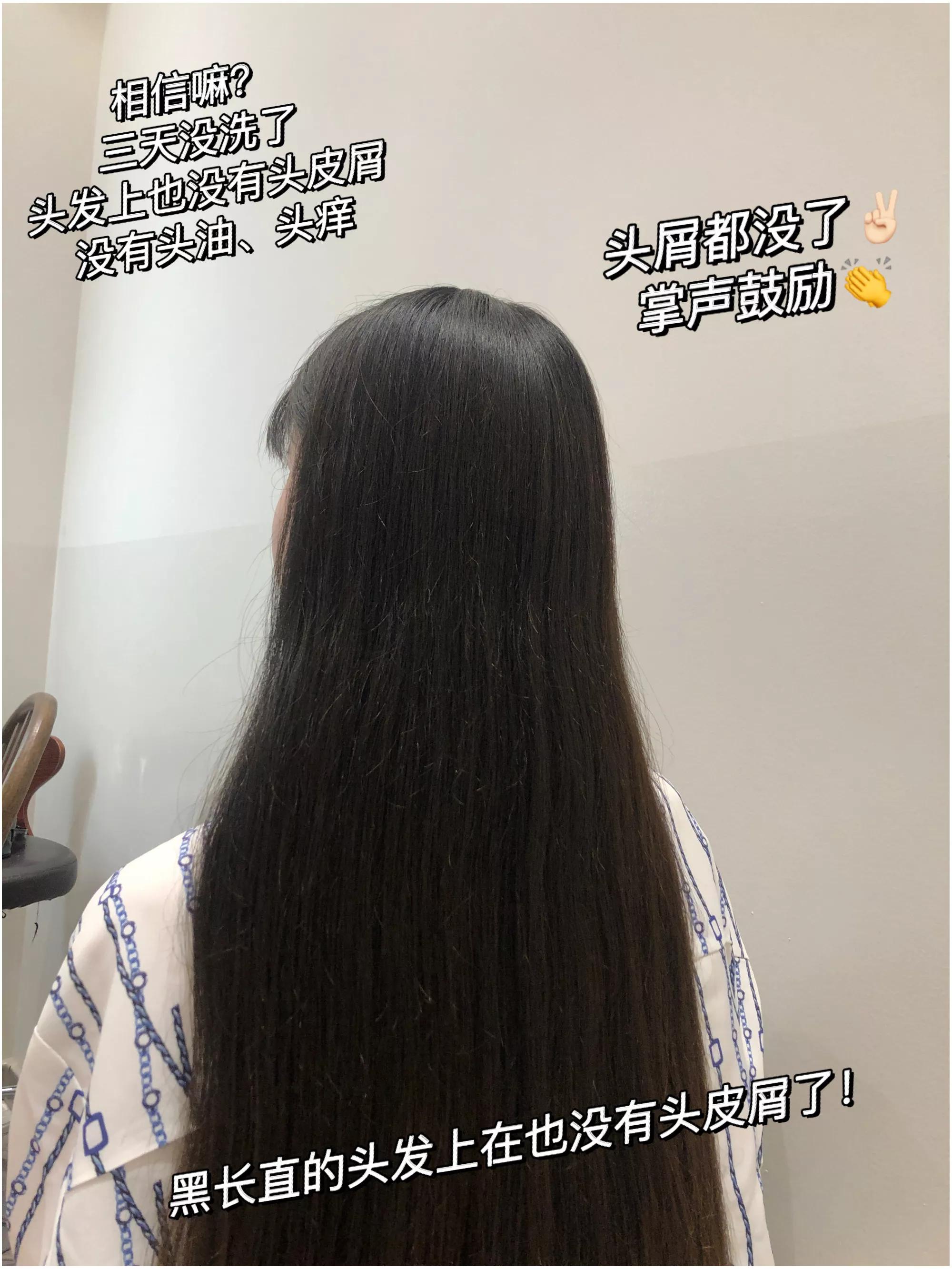 为什么从来没有头屑,你还在为头屑而烦恼吗