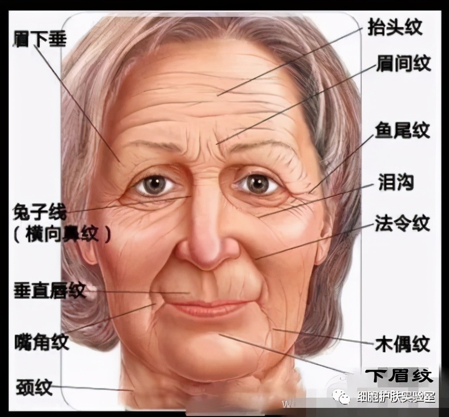 修复眉间纹最好的方法,额头皱纹眉间纹