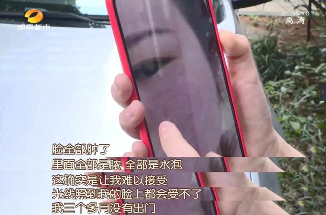 女子对化妆品上瘾,皮肤对护肤品上瘾新闻后续