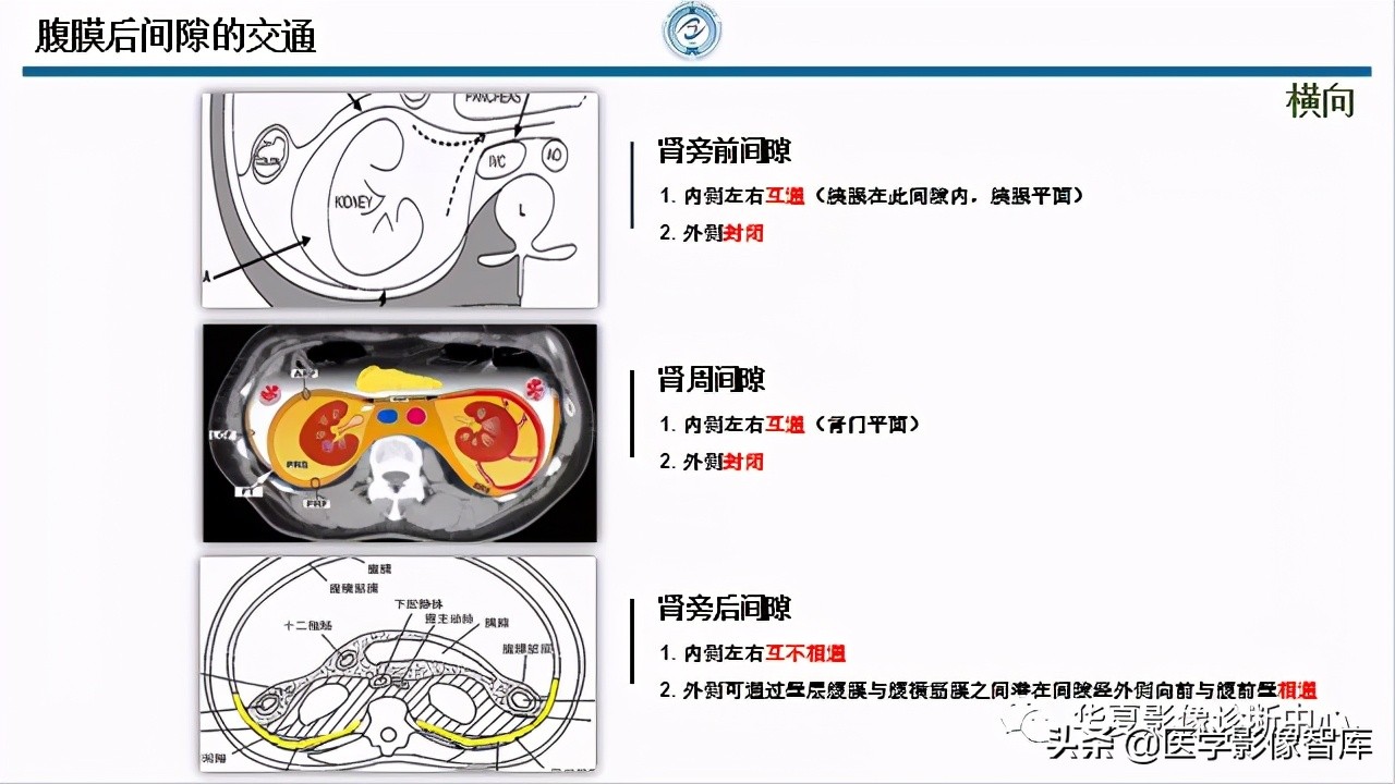 核磁ct都显示急性胰腺炎,急性坏死性胰腺炎的ct表现