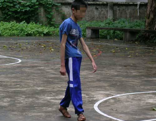 外八字脚会不会影响膝盖,跑步时八字脚产生原因及纠正方法