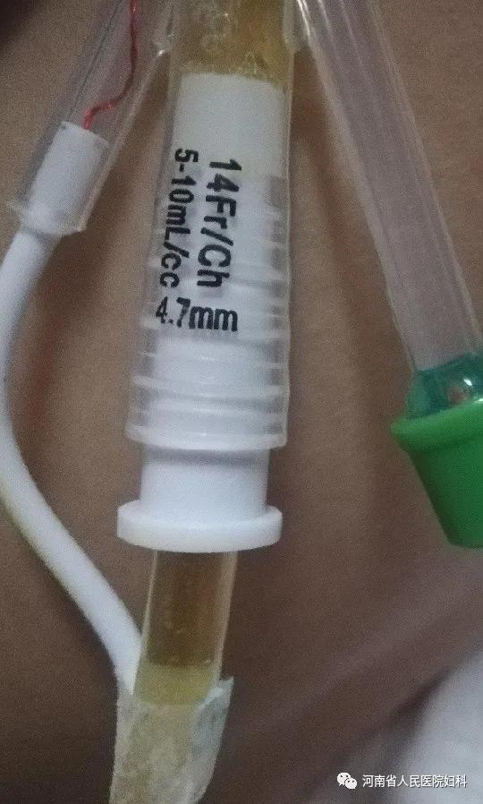 河南省人民医院妇科医生,河南省第三人民医院妇科怎么样