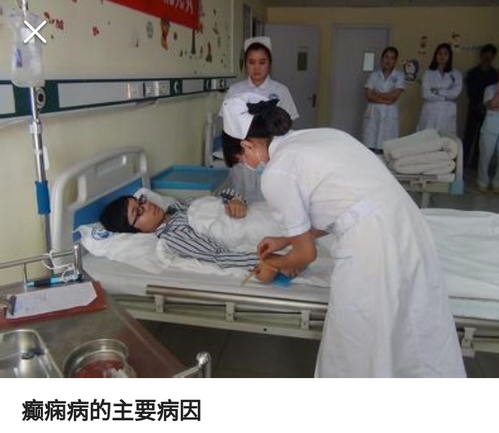 癫痫病可以用中药调理吗,癫痫病能用中药调理吗