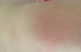 这支小青膏真的好！我带俩娃来为它正名