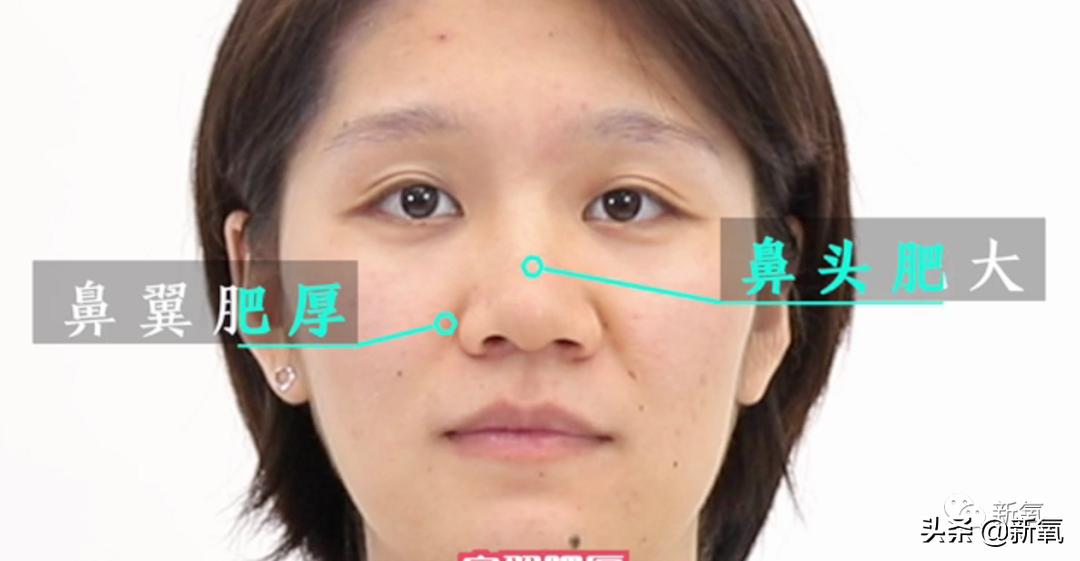 鞠婧祎鼻子有多漂亮,如何变成鞠婧祎同款鼻子