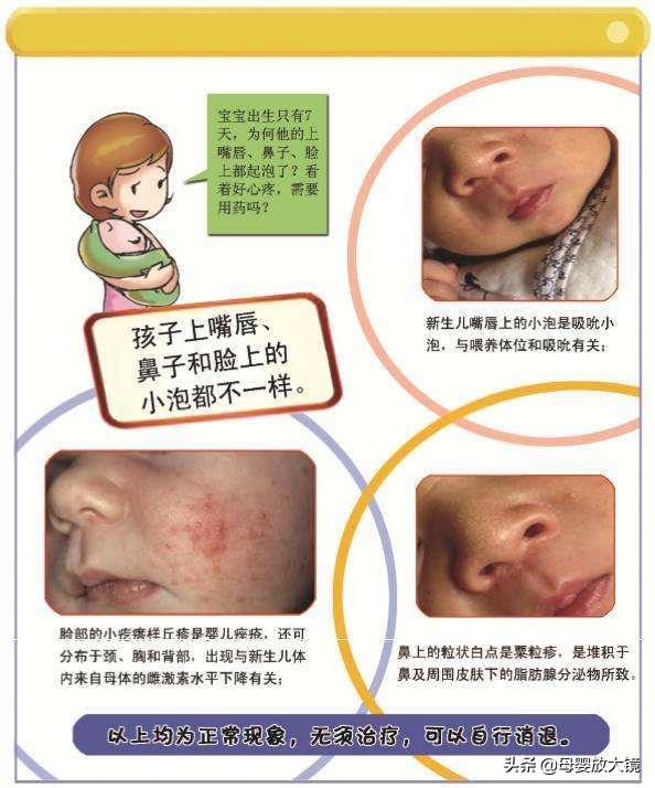 新生宝宝的一些正常现象,天使宝宝的症状有哪些