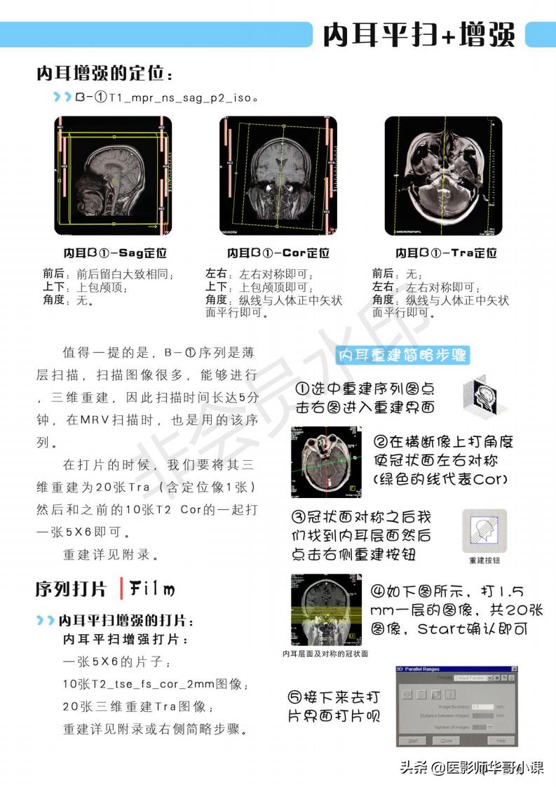 磁共振扫描技术西门子,西门子磁共振最新操作界面
