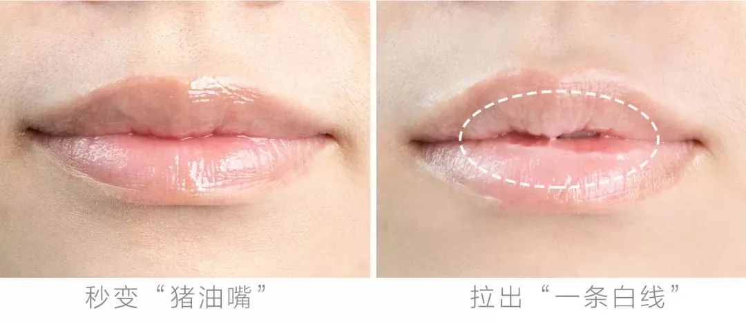 在线等,接吻时咬下女友的死皮,怎么办?