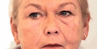 美白成分中谁最有用,美白成分一般排在第几位