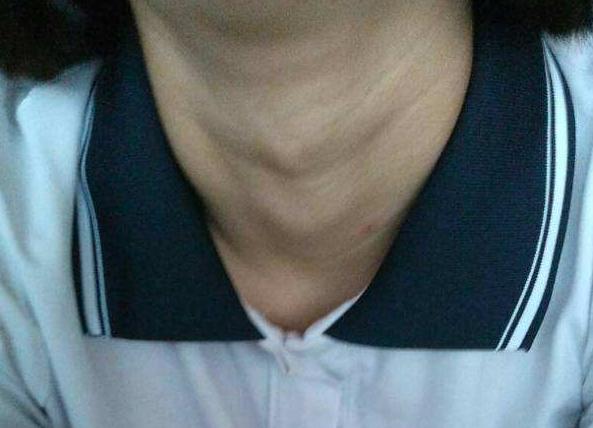 12岁女孩长胡子喉结,女生12岁长喉结不能吃什么