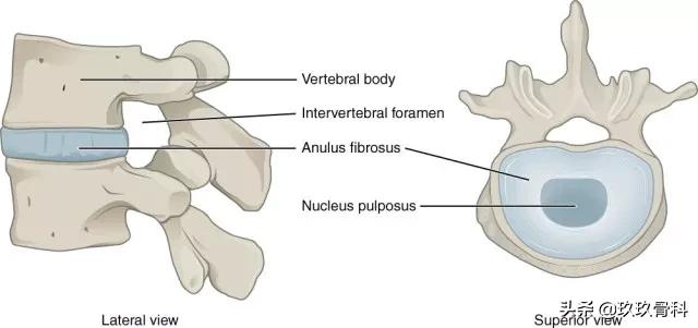 图解腰椎间盘突出,椎间盘髓核膨出图