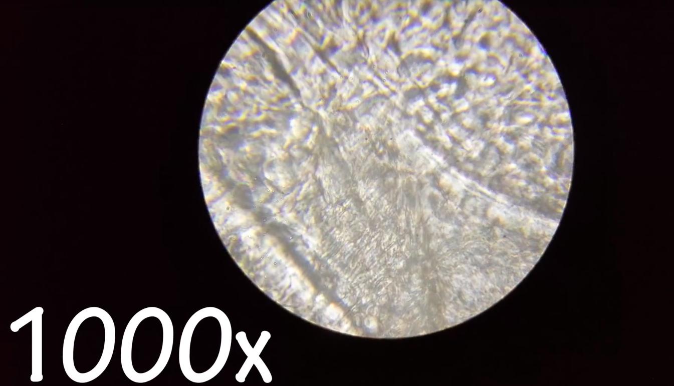 在显微镜下的耳屎有多脏,把耳屎放在显微镜下是什么
